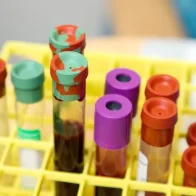 Exames laboratoriais
